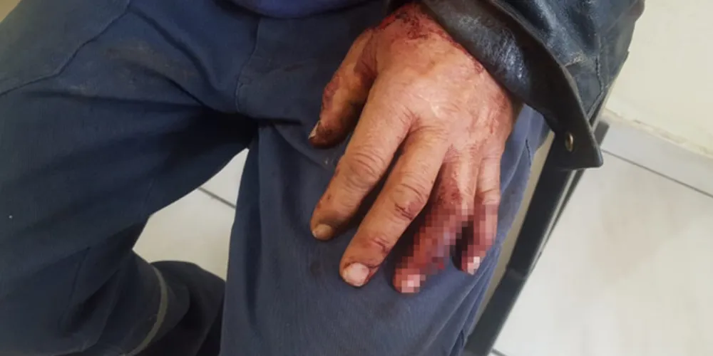 Imagem ilustrativa da imagem Homem é agredido por filho e enteado na Vila Cipa