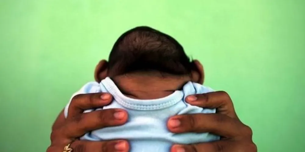 Testes realizados em camundongos demonstraram que a infecção do Zika vírus também pode causar convulsões em consequência de danos permanentes no cérebro / Foto Reprodução VEJA