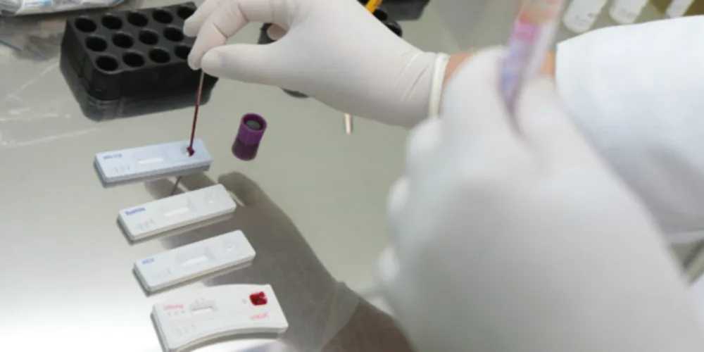 Desde 2013, SUS oferece gratuitamente tratamento antirretroviral que é considerado modelo mundial 