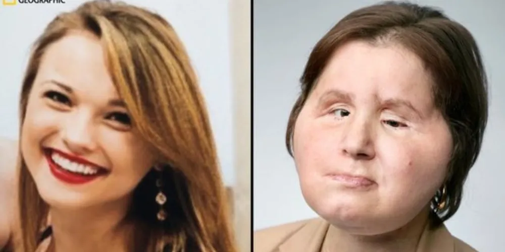 Katie Stubblefield tem segunda chance após ser levada no hospital com ferimentos graves