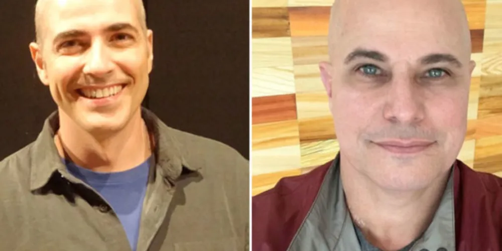 Atores Reinal Janequini e Edson Celulari já foram vítimas do linfoma de Hodgkin.