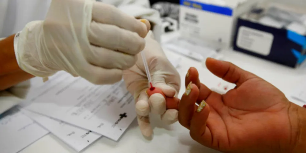 Imagem ilustrativa da imagem Aids: da epidemia mundial ao tratamento gratuito no Brasil