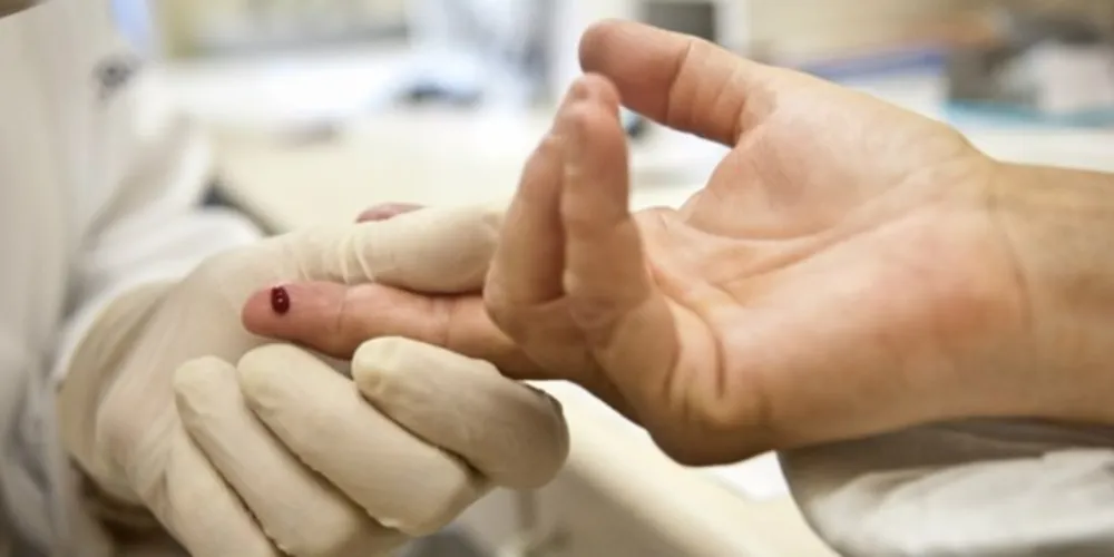 Primeiro caso de AIDS no Brasil foi confirmado em 1982.