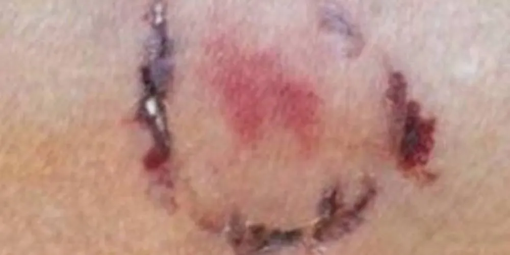 Ao se defender, vítima acabou sendo mordida pela dona do animal. 