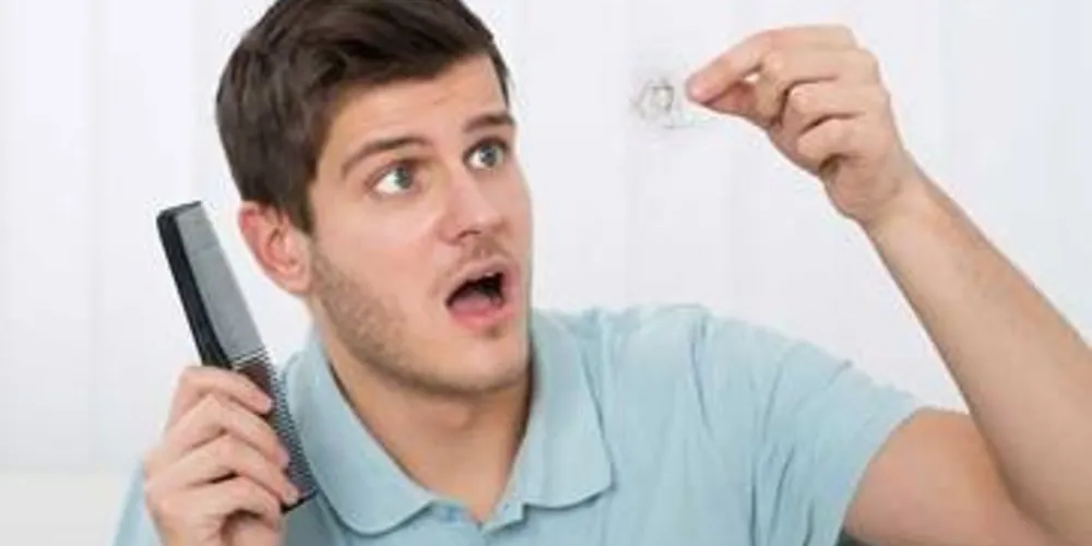 Jovens com idade entre 20 e 25 anos que estão sofrendo com a queda de fios