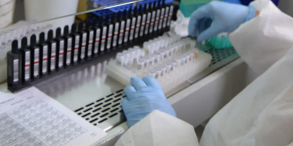 Laboratórios do Lacen e Fiocruz-PR examinaram material coletado há dois dias