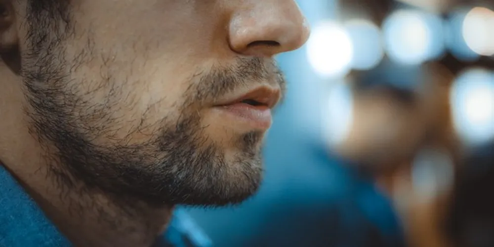 Imagem ilustrativa da imagem Barba falhada: ela virou moda!