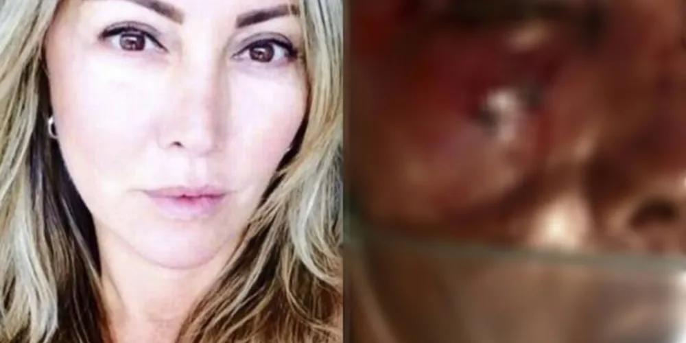 Vítima ficou com o rosto desfigurado após ser espancada
