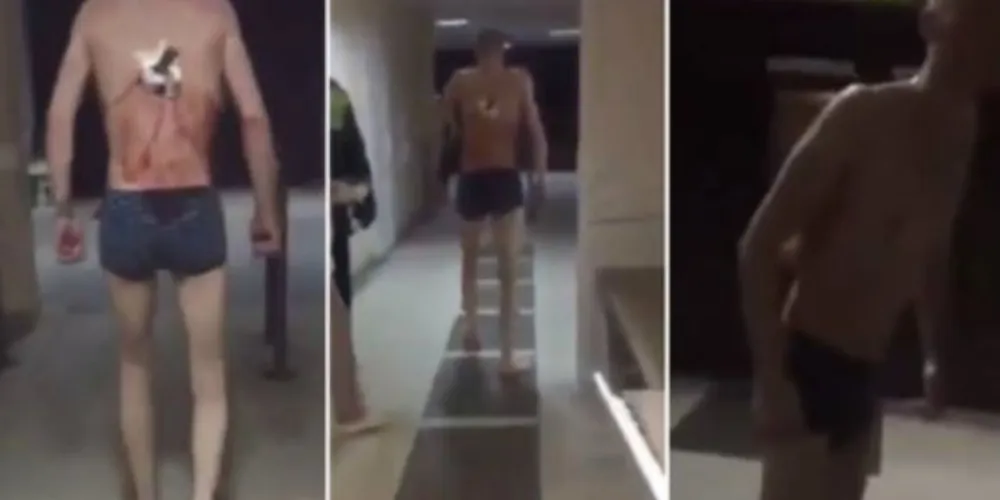 Nas imagens é possível ver o paciente, identificado apenas como Vladimir, andando com a faca nas costas 