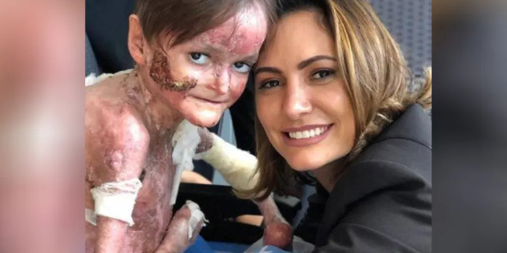 Imagem ilustrativa da imagem Michelle Bolsonaro se emociona com jovem de doença rara