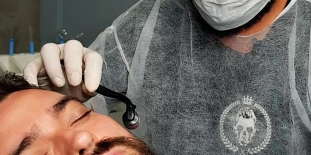 Imagem ilustrativa da imagem Barbearia de PG inova com tratamento para calvície