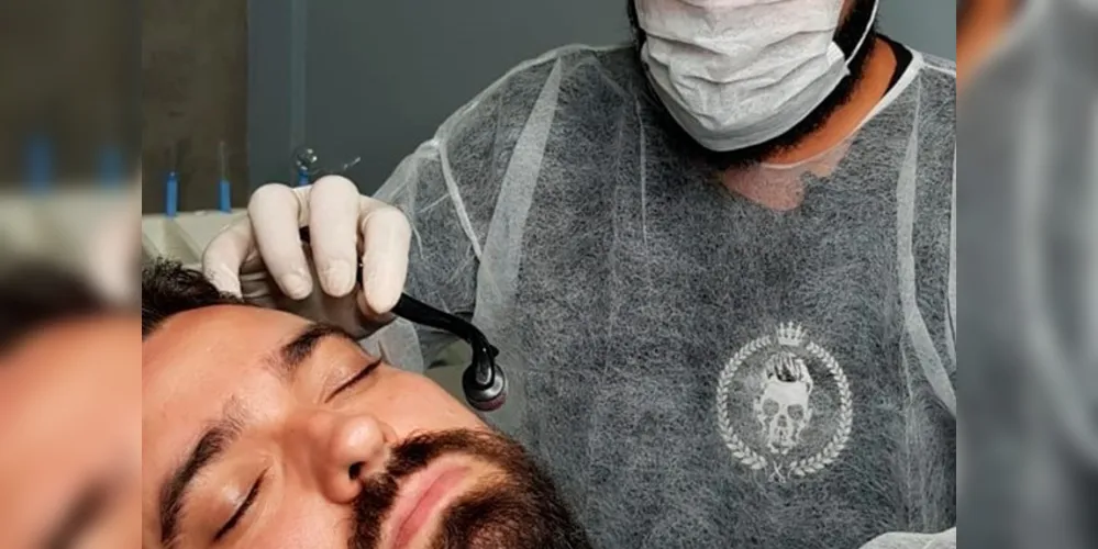 Imagem ilustrativa da imagem Barbearia de PG inova com tratamento para calvície