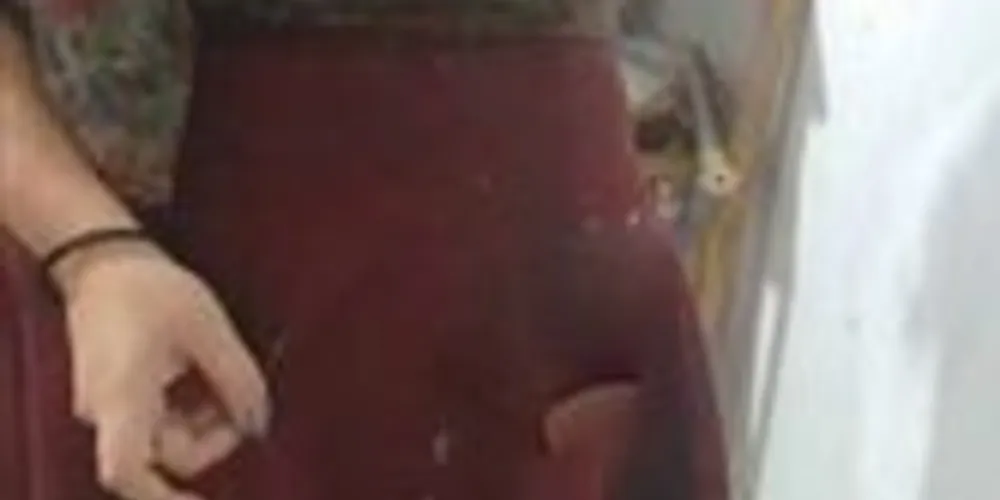 Na foto aparece o que seria a ejaculação do abusador. 