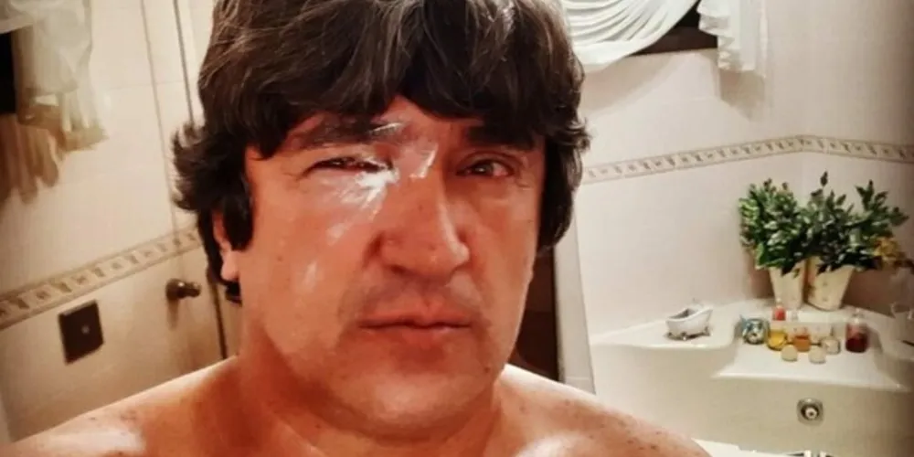 Imagem ilustrativa da imagem Secretário ‘superman’ aparece de olho roxo e intriga internautas