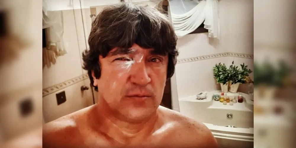 Imagem ilustrativa da imagem Secretário ‘superman’ aparece de olho roxo e intriga internautas