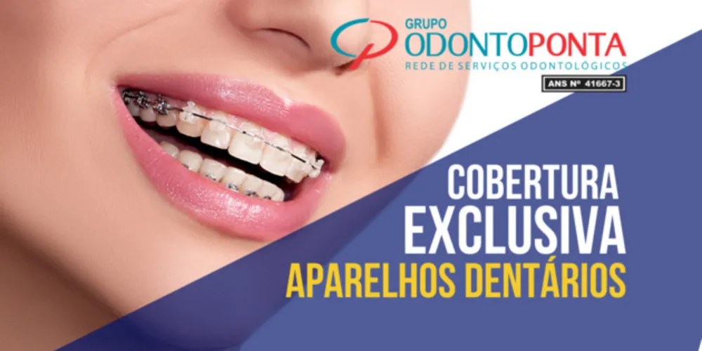 Imagem ilustrativa da imagem Odontoponta conta com convênio para aparelhos dentários