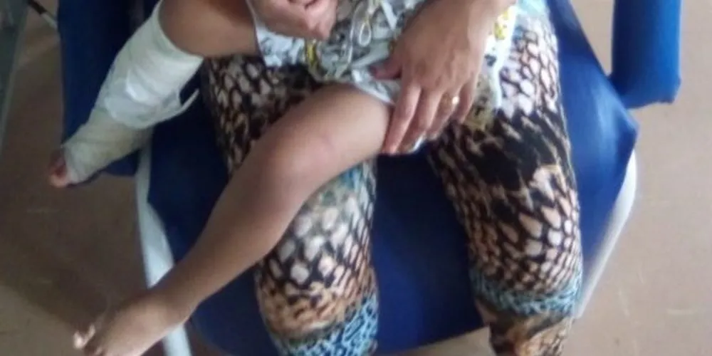 Imagem ilustrativa da imagem Menina de 3 anos tem perna rasgada por escada rolante