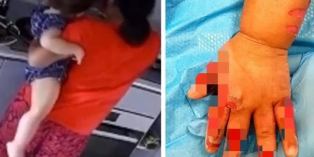 Segundo o relato da mãe, que denunciou os maus-tratos, a babá da criança disse que cometeu o ato para 'ir para casa'.