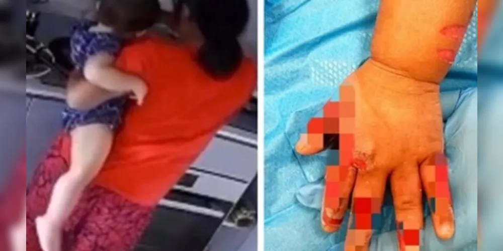 Segundo o relato da mãe, que denunciou os maus-tratos, a babá da criança disse que cometeu o ato para 'ir para casa'.