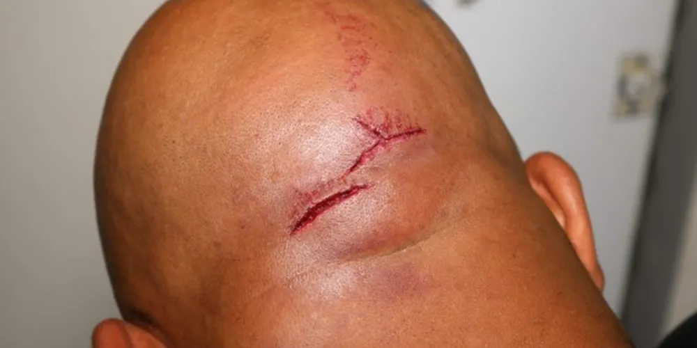 Vítima foi ferida com um golpe de faca na cabeça e teve R$ 350 em espécie roubada