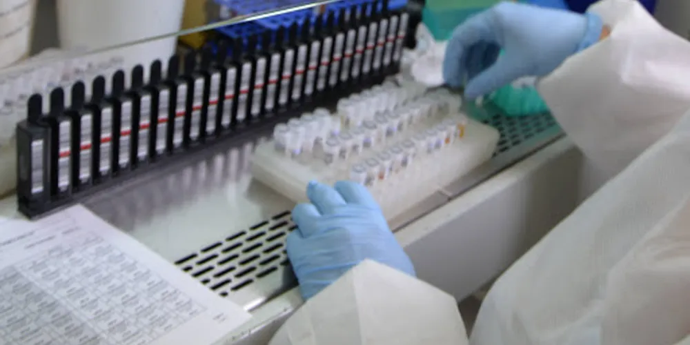 As novas epizootias aconteceram nos municípios de São João do Triunfo, com quatro casos; e Castro, que apresentou um caso