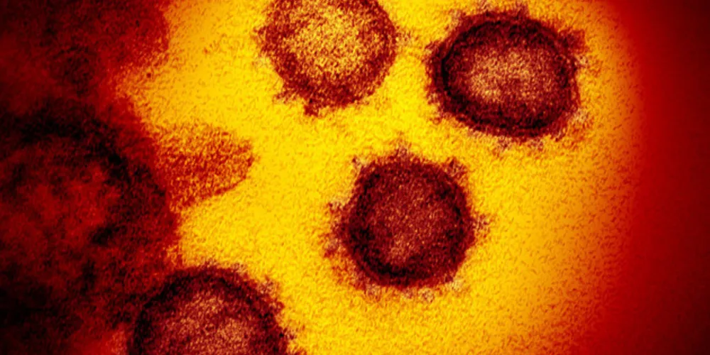 Imagem do microscópio eletrônico de transmissão mostra o SARS-CoV-2 – também conhecido como 2019-nCoV, o vírus que causa o COVID-19