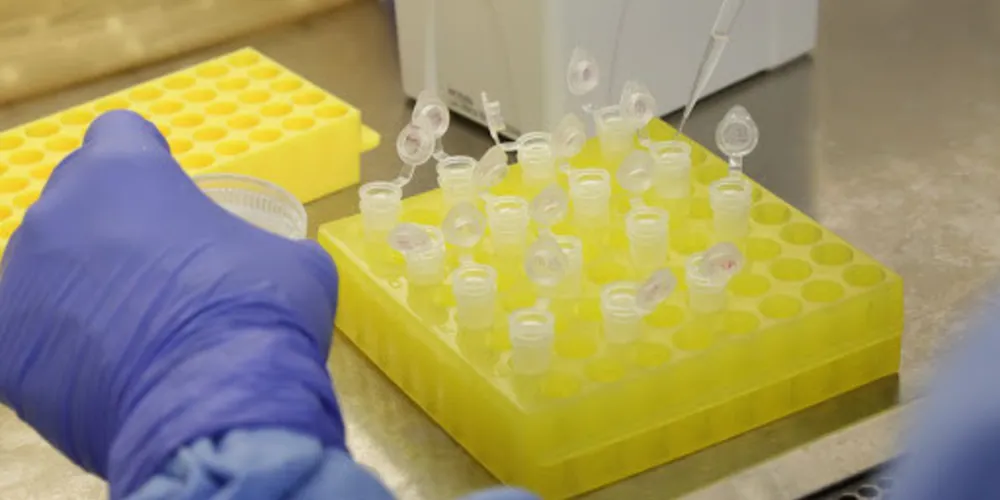 Imagem ilustrativa da imagem Autoridades descartam caso de coronavíurus em PG