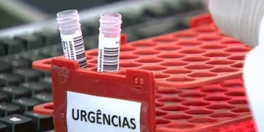 O estado de São Paulo concentra o maior número de casos confirmados da doença