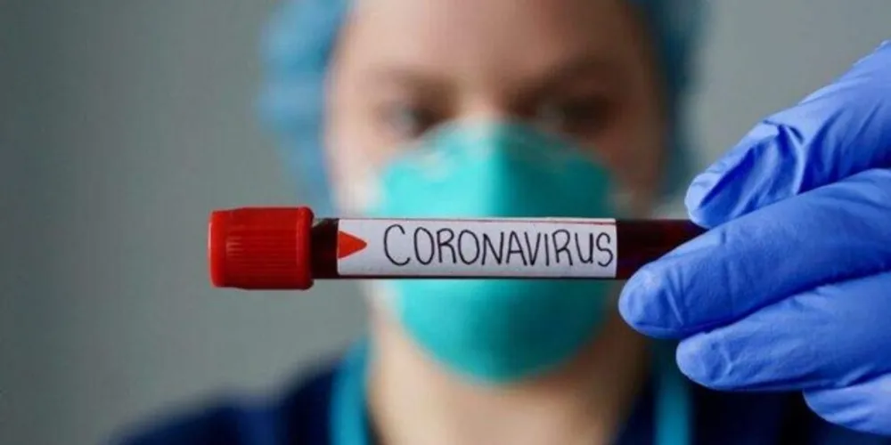 No total, o Brasil tem 3 mortos e mais de 300 casos confirmados