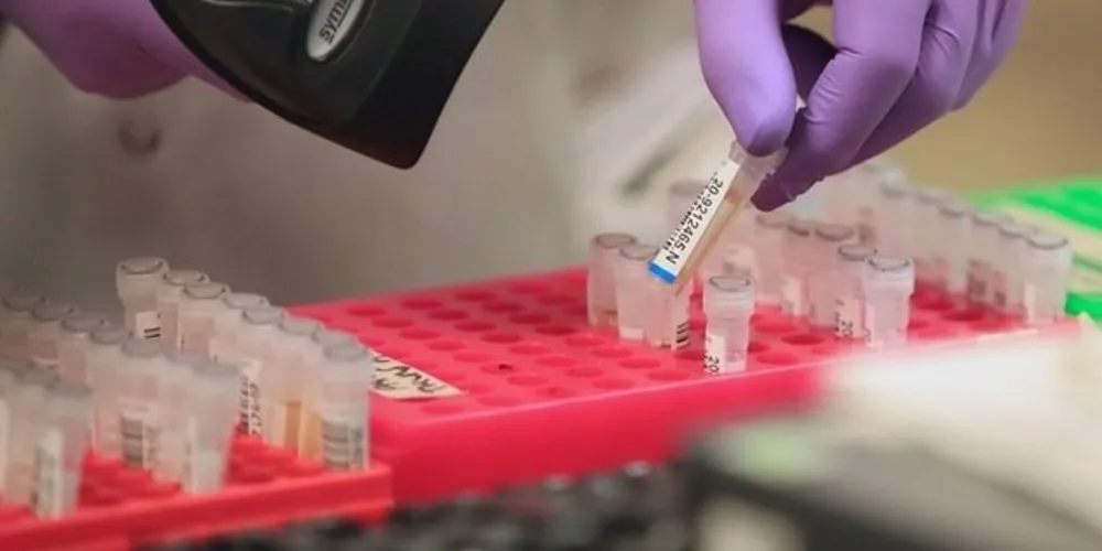 Em todo o país, os casos já passam de 500, segundo dados das secretarias estaduais de saúde