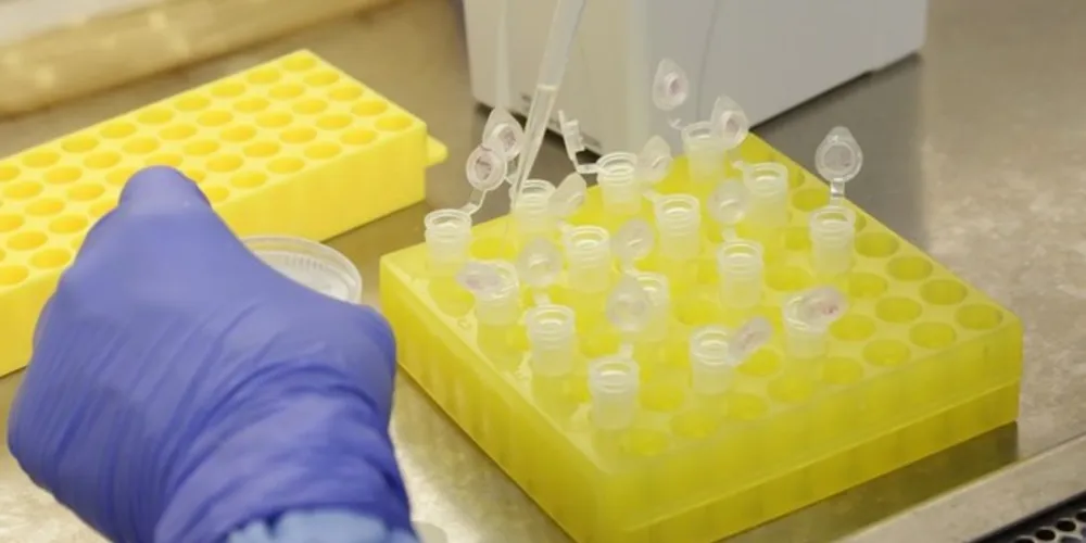 Imagem ilustrativa da imagem PG tem 56 casos descartados de coronavírus