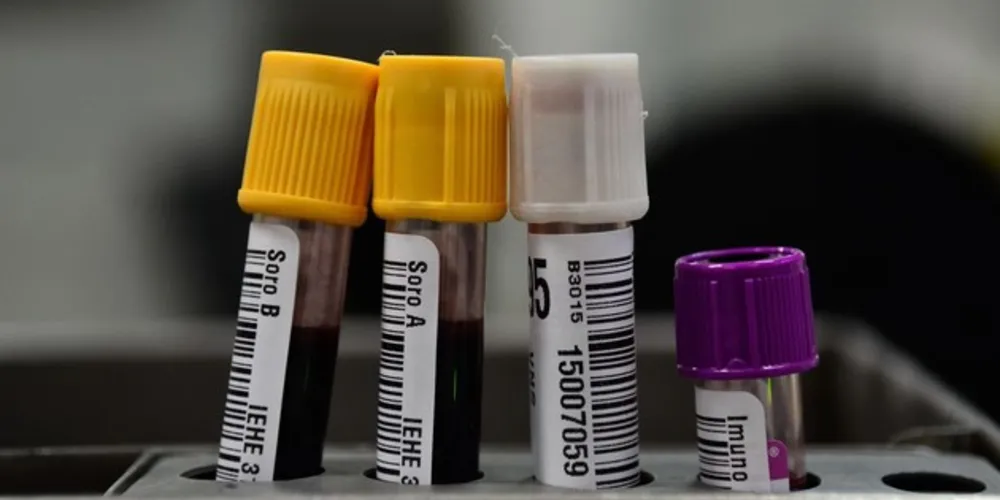 Pacientes que já se curaram da doença estão sendo convocados e serão avaliados como potenciais doadores de plasma