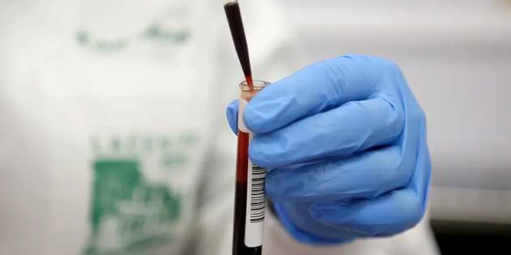 Taxa de mortalidade está em 7%