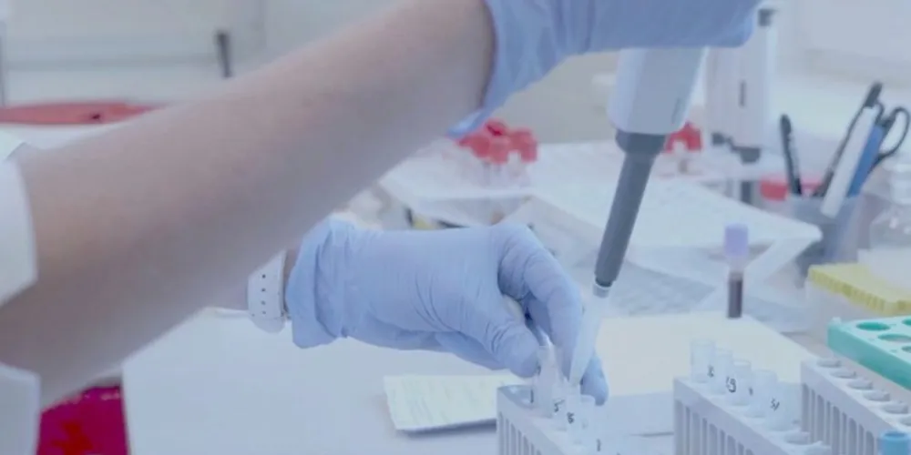 PG já tem 42 casos recuperados