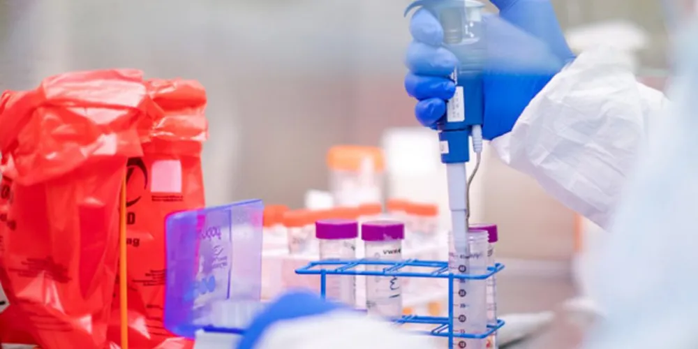 Exame que confirmou doença foi realizado em laboratório particular de Tibagi