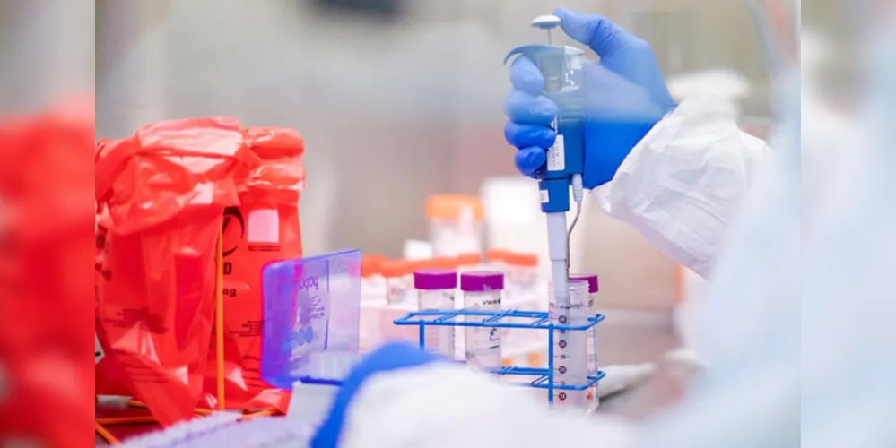 Exame que confirmou doença foi realizado em laboratório particular de Tibagi