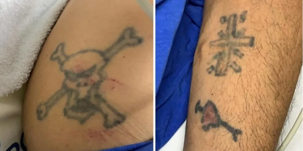 Atropelado em Castro, paciente foi transferido para o HU e ainda não foi identificado oficialmente