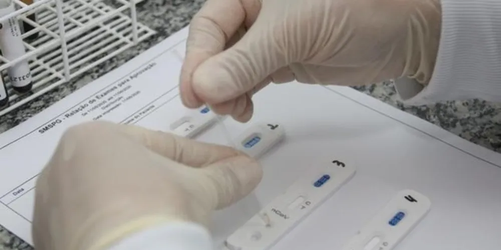 Inicialmente foram disponibilizados 4800 testes rápidos para Ponta Grossa
