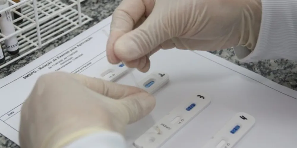 A testagem iniciará com os trabalhadores que estão de frente para a linha de atendimento à população