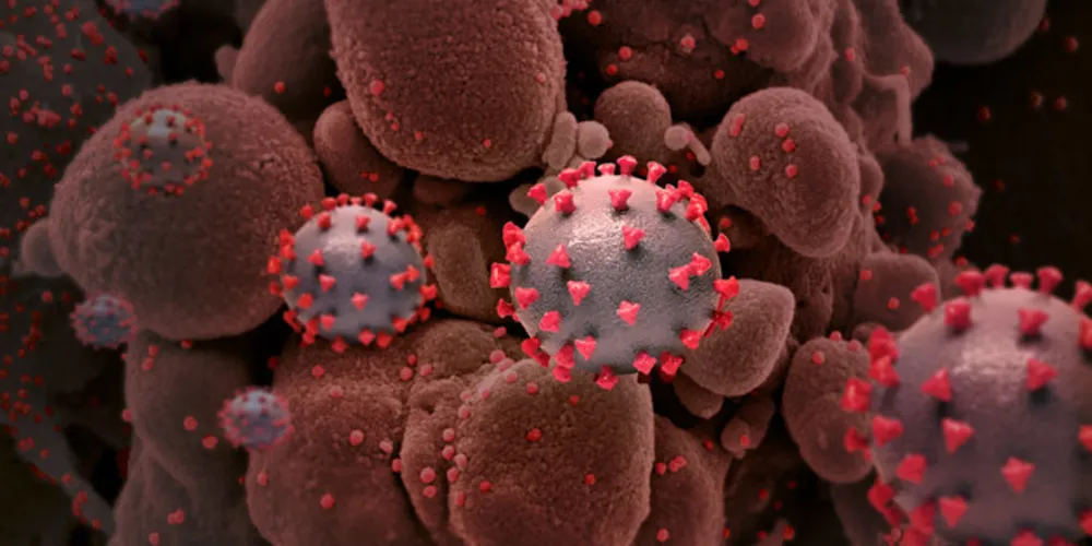 Nas últimas 24 horas, foram confirmados 6674 novos casos e 14 mortes no Paraná