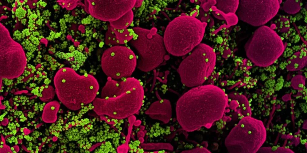 A vacina está sendo testada no Brasil