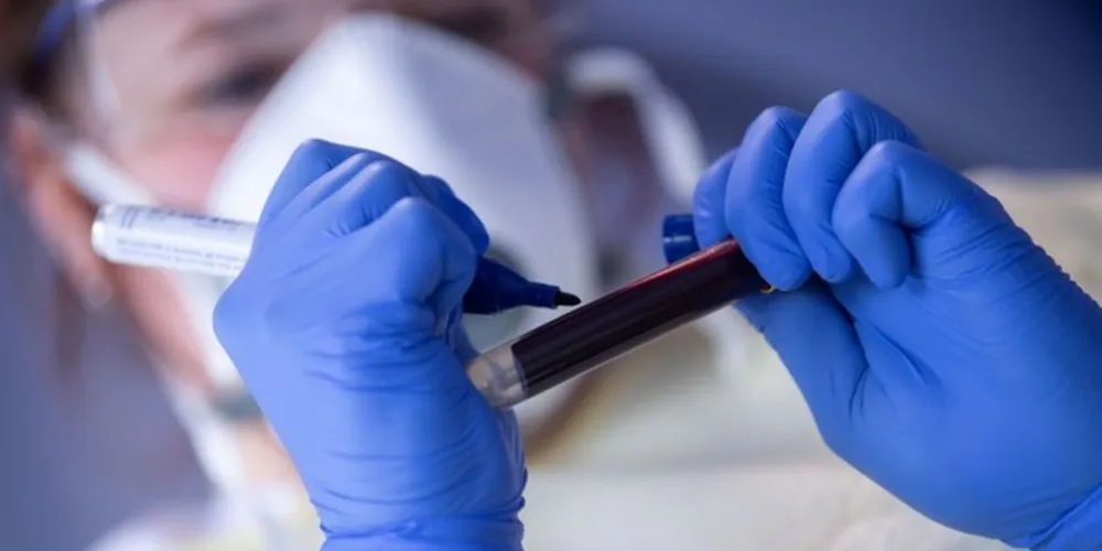 Para 45,4%, volume de casos e mortes por Covid-19 é superior ao informado pelo Ministério da Saúde