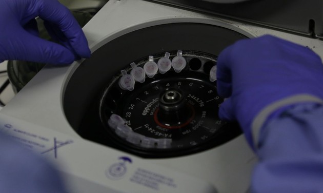 A plataforma está em fase avançada para obtenção de anticorpos monoclonais para o tratamento de zika e tétano