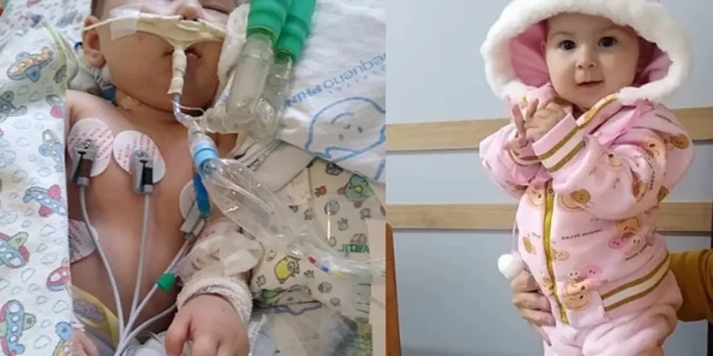 Pequena Lavínia de nove meses possui uma doença rara causada por uma combinação de quatro defeitos cardíacos