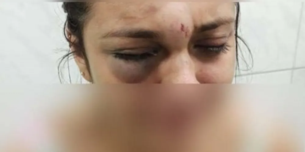 Na publicação, ela relata um episódio de violência que afirma ter sofrido por parte do namorado, com quem contou ter vivido um relacionamento abusivo. 