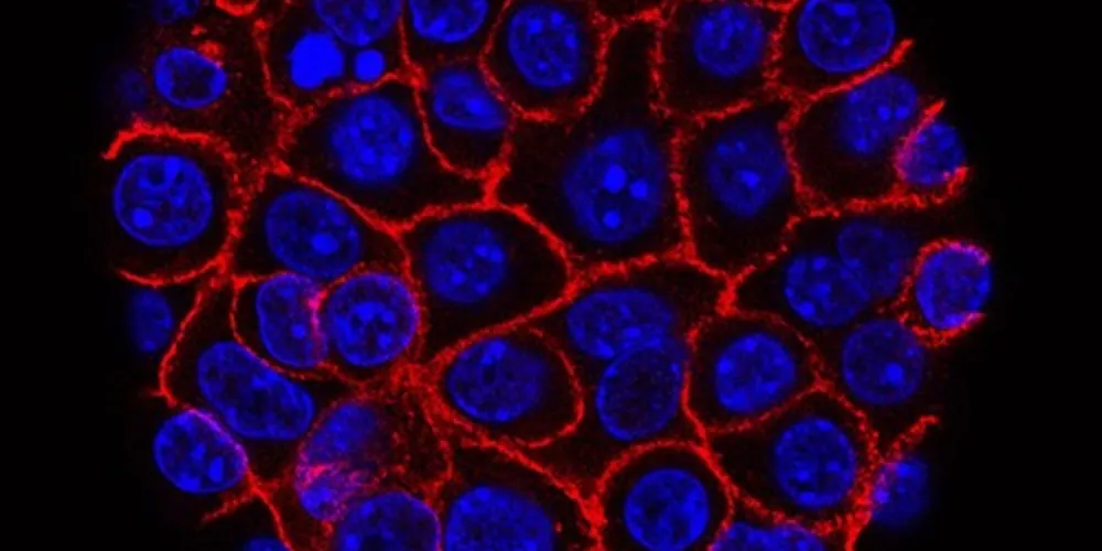 A pesquisa reuniu amostras de mais de 120 mil pessoas, coletadas entre 2007 e 2017.