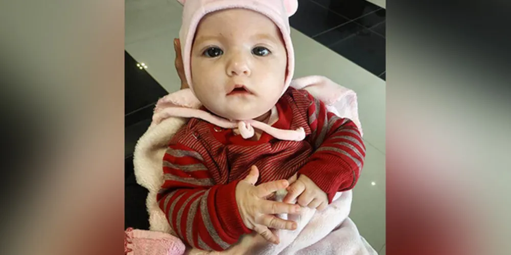 Maria Laura nasceu com síndrome extremamente rara e precisa de cirurgia para levar vida confortável