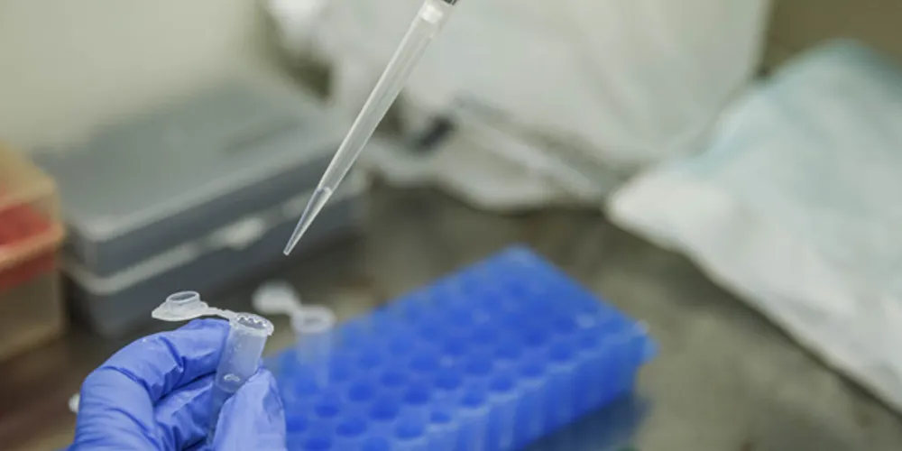 Brasil registra 1.212 óbitos e 52.383 casos nas últimas 24h | 