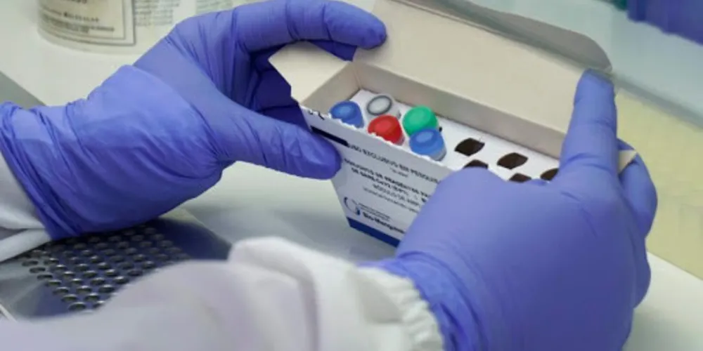 Imagem ilustrativa da imagem Covid-19: Saiba quais são os números atuais em PG