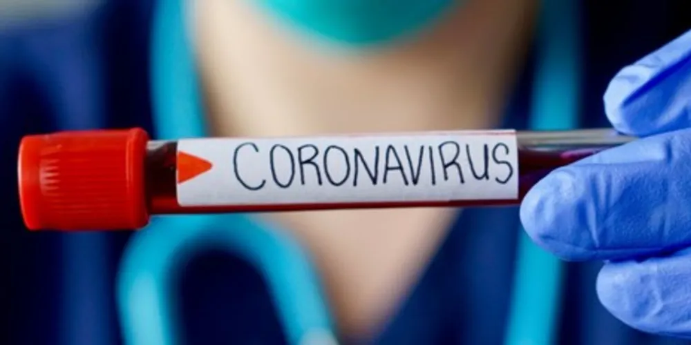 As primeiras 15 milhões de doses disponibilizadas pela Fiocruz só chegarão em janeiro de 2021.